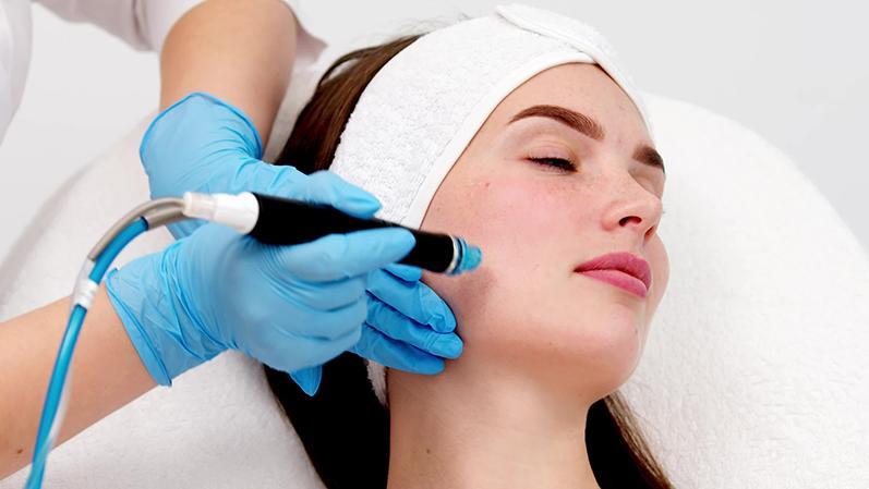 The Magic of Micro needling: Rejuvenate Your Skin Naturally